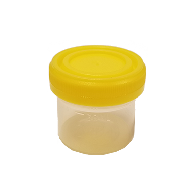 40 ml yellow top