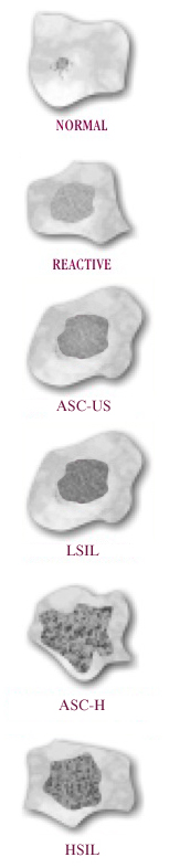 asc-us